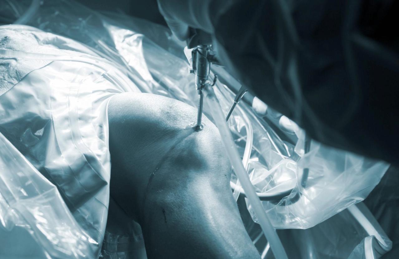 ACL tear vs meniscus tear difference in Bangalore